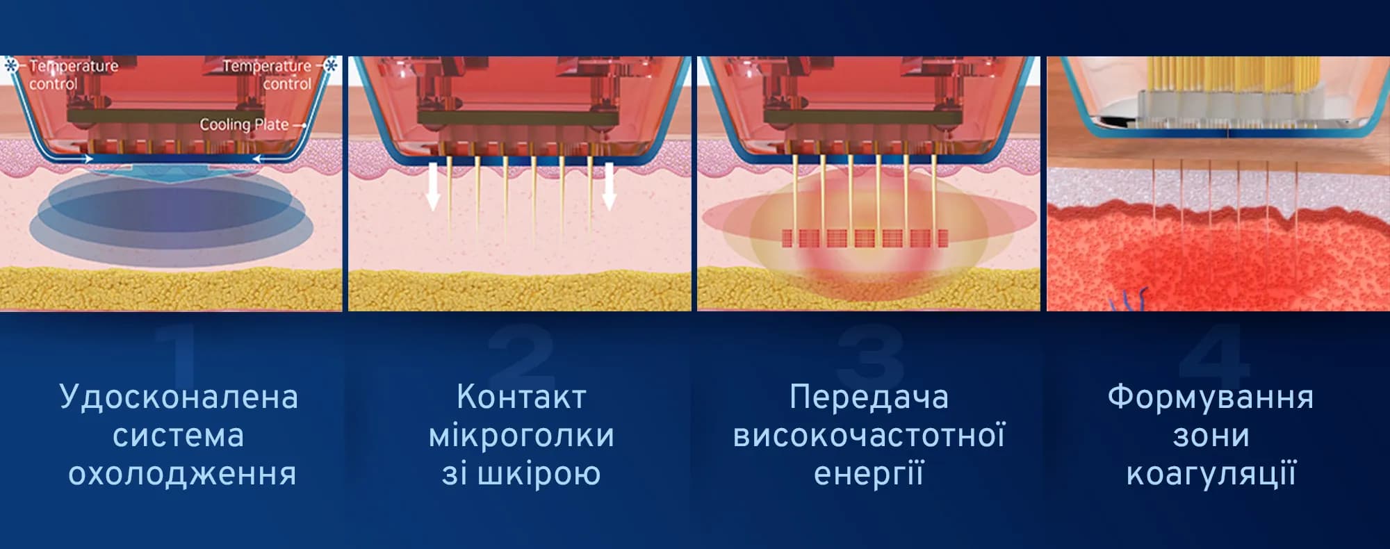 RF-енергія, випромінювана мікроголками, викликає регенерацію тканин завдяки ефекту коагуляції.